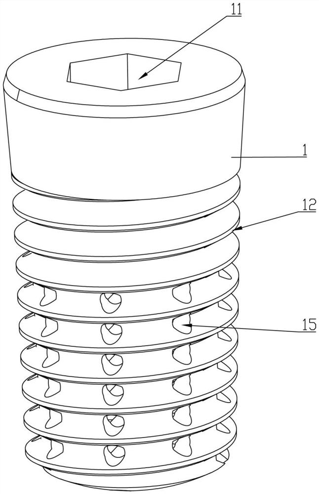 Composite dental implant and preparation method thereof