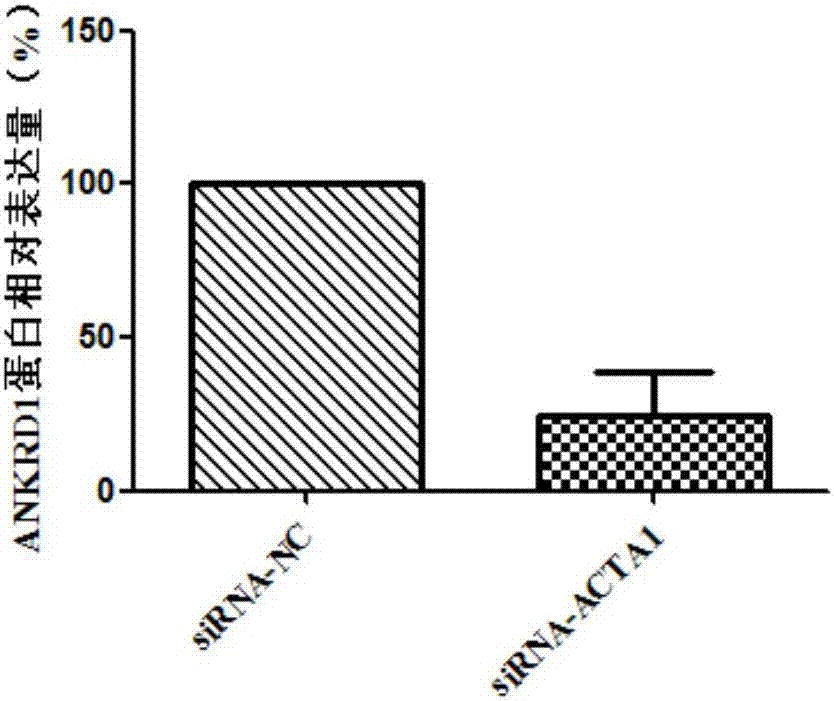 ANKRD1 as diagnosis and treatment target of tongue squamous cell carcinoma