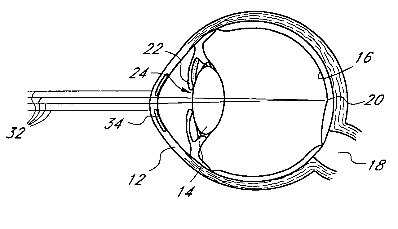 Mask configured to maintain nutrient transport without producing visible diffraction patterns