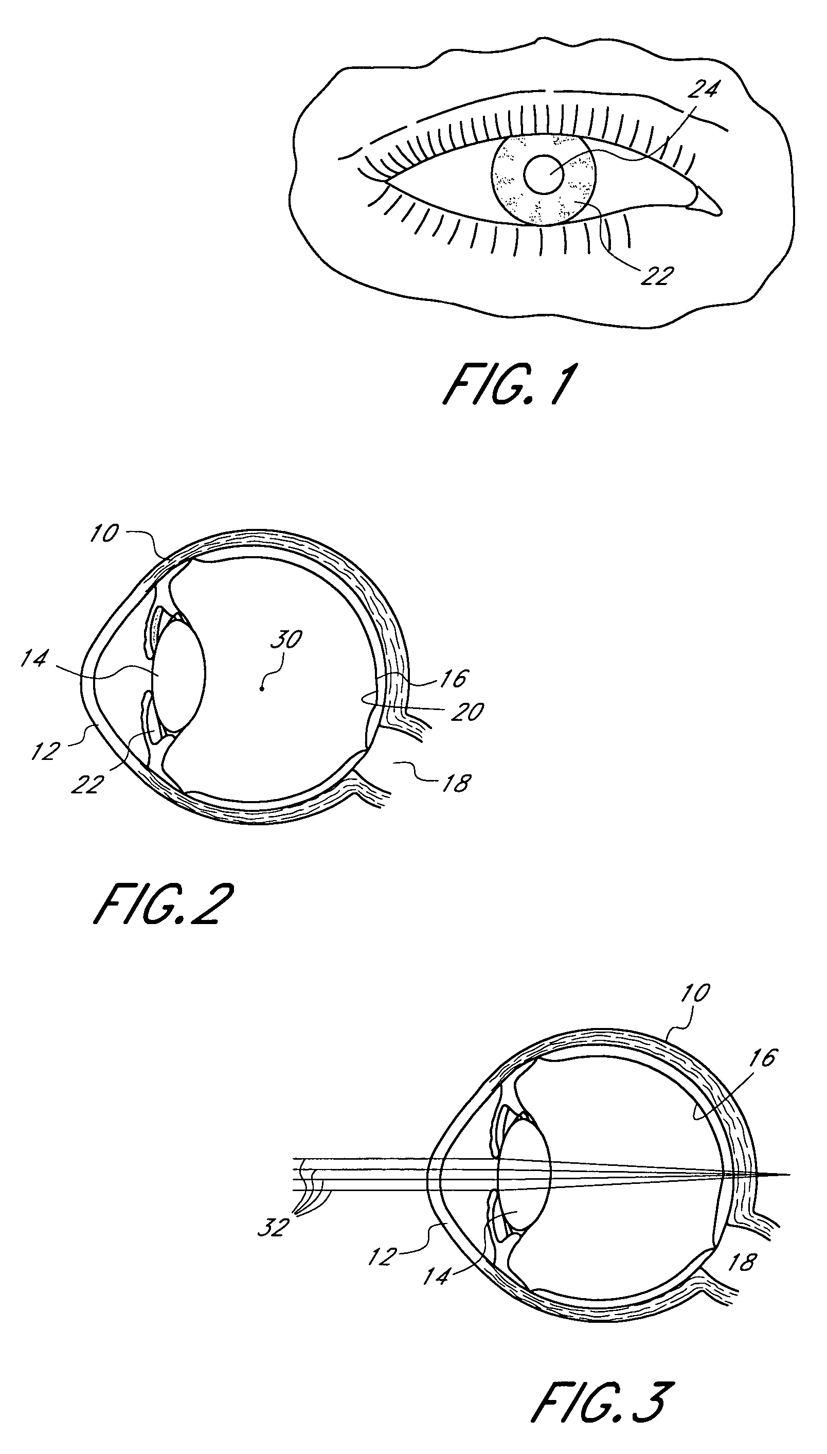 Mask configured to maintain nutrient transport without producing visible diffraction patterns