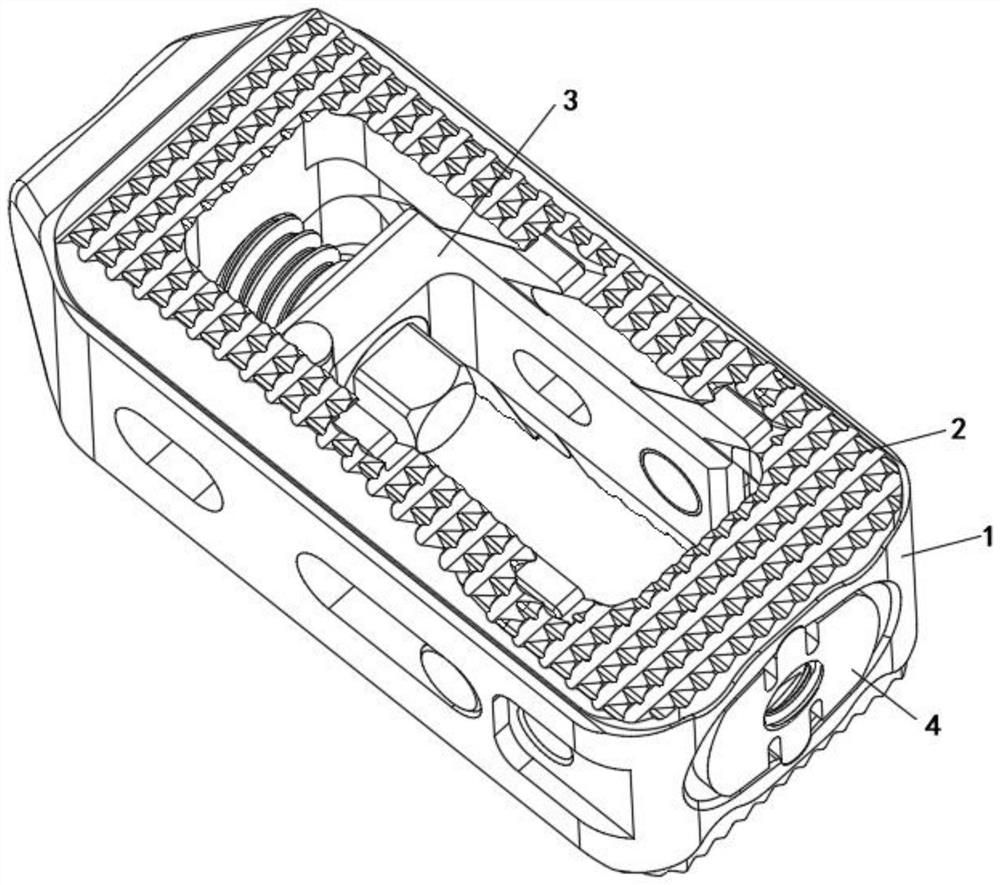 Fusion cage with adjustable post-grafted bone height