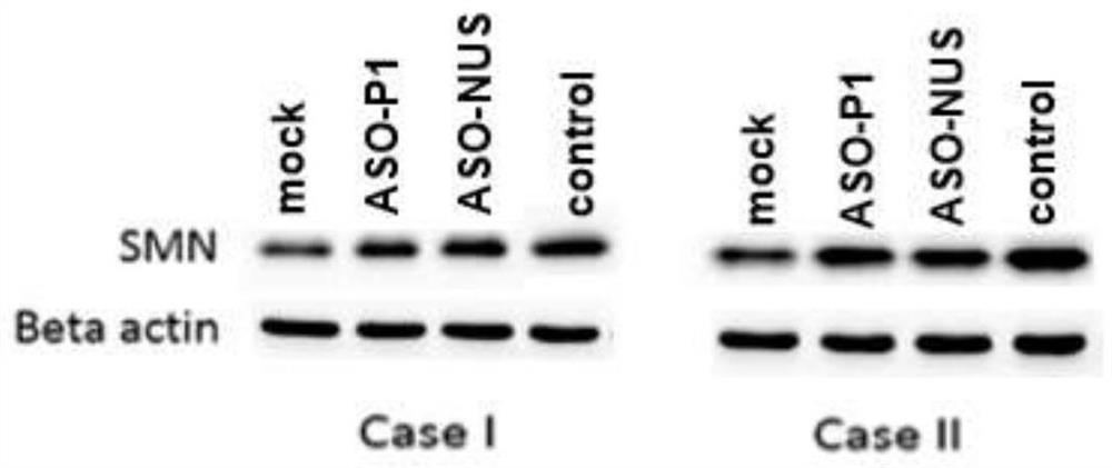 And antisense oligonucleotide is used for targeting region where methylation site nt-290 of SMN2 promoter region is located