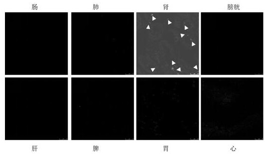 Kidney-targeted drug-loaded exosome, application and medicine for treating kidney diseases