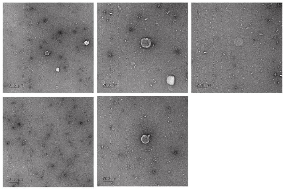Cosmetic composition containing galactomyces-derived exosome as active ingredient