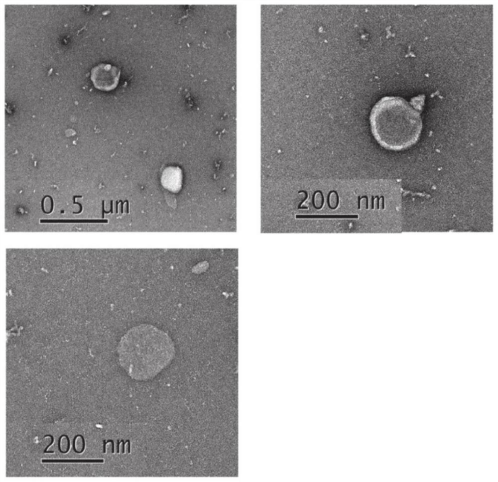 Cosmetic composition containing galactomyces-derived exosome as active ingredient