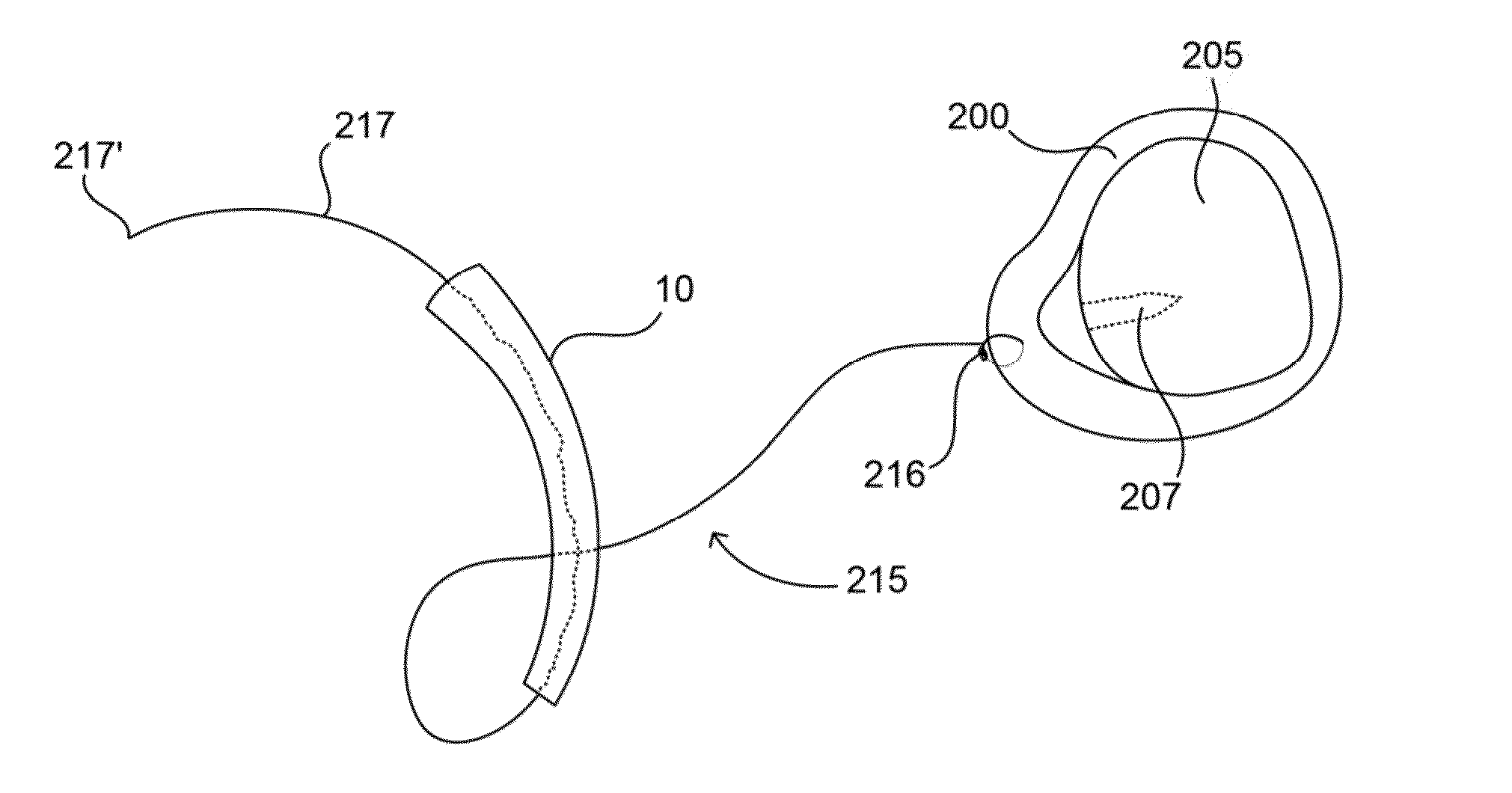 Surgical instruments and methods of use