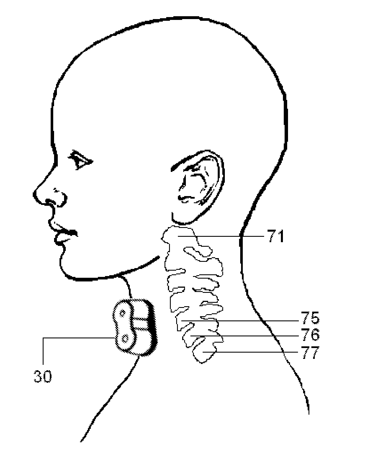 Magnetic stimulation devices and methods of therapy