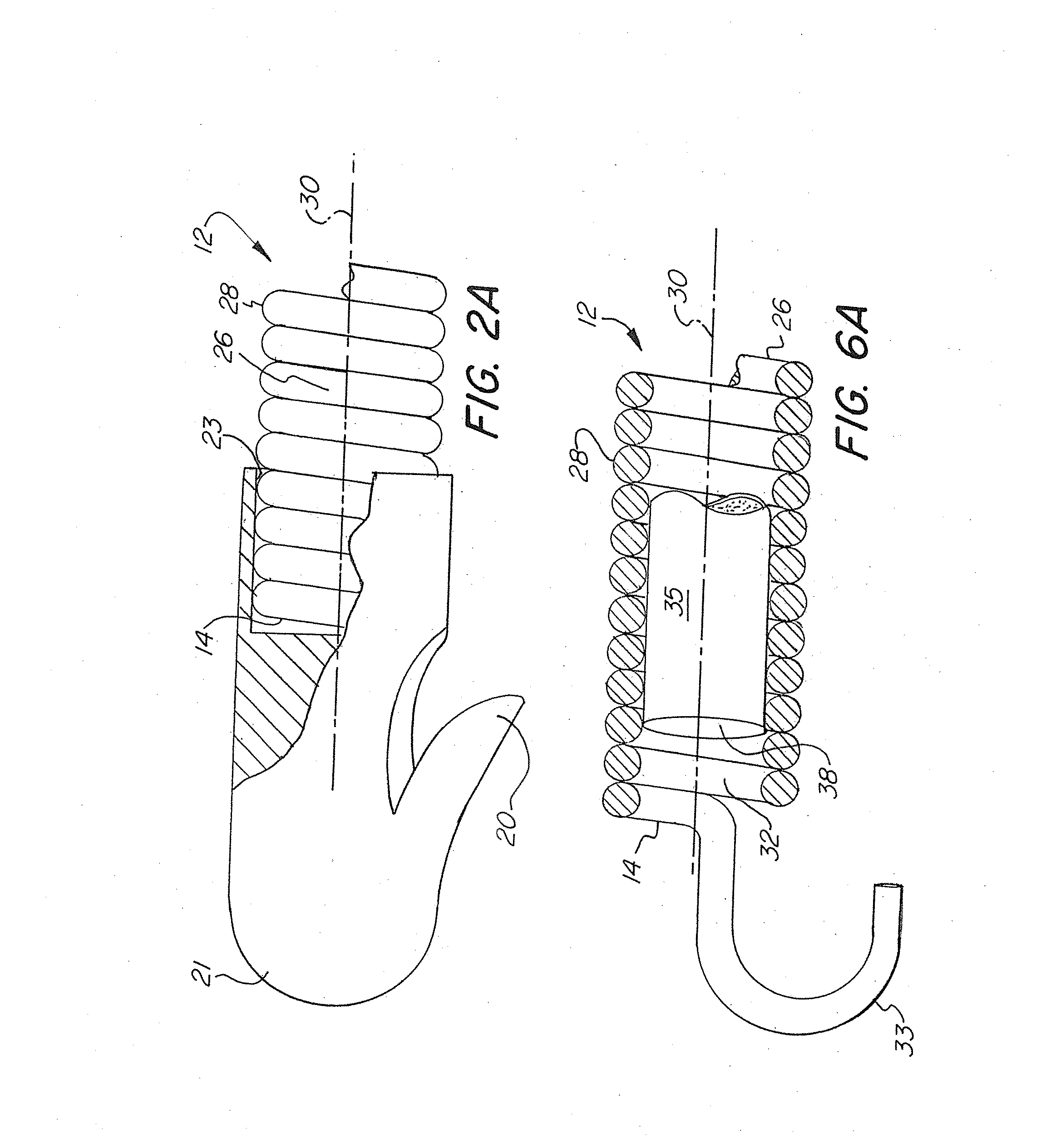 Flexible, self expansible, removable memory coil intragastric device and method of using such device for weight reduction and medication delivery