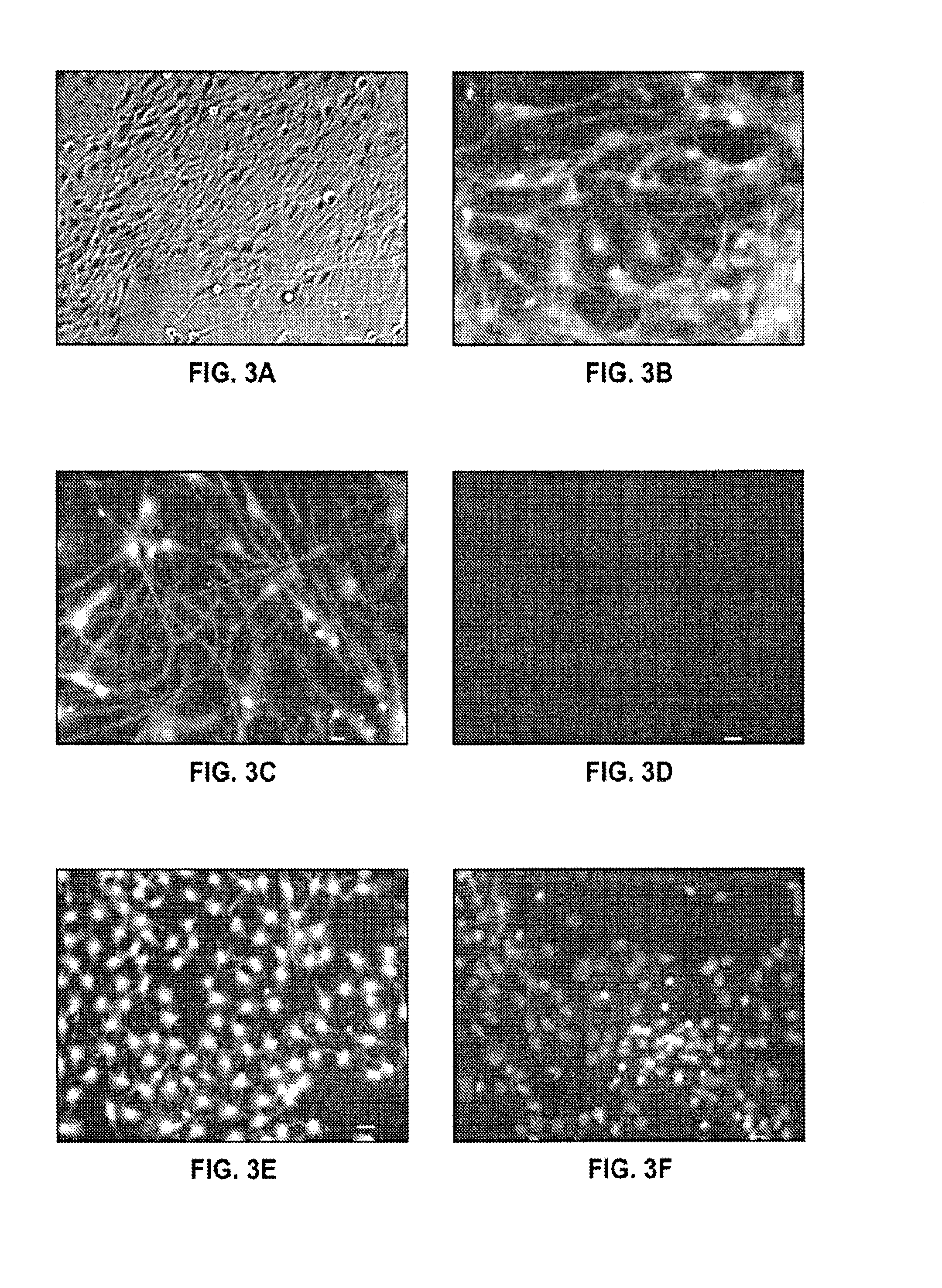 Endorphin Therapy Compositions and Methods of Use Thereof