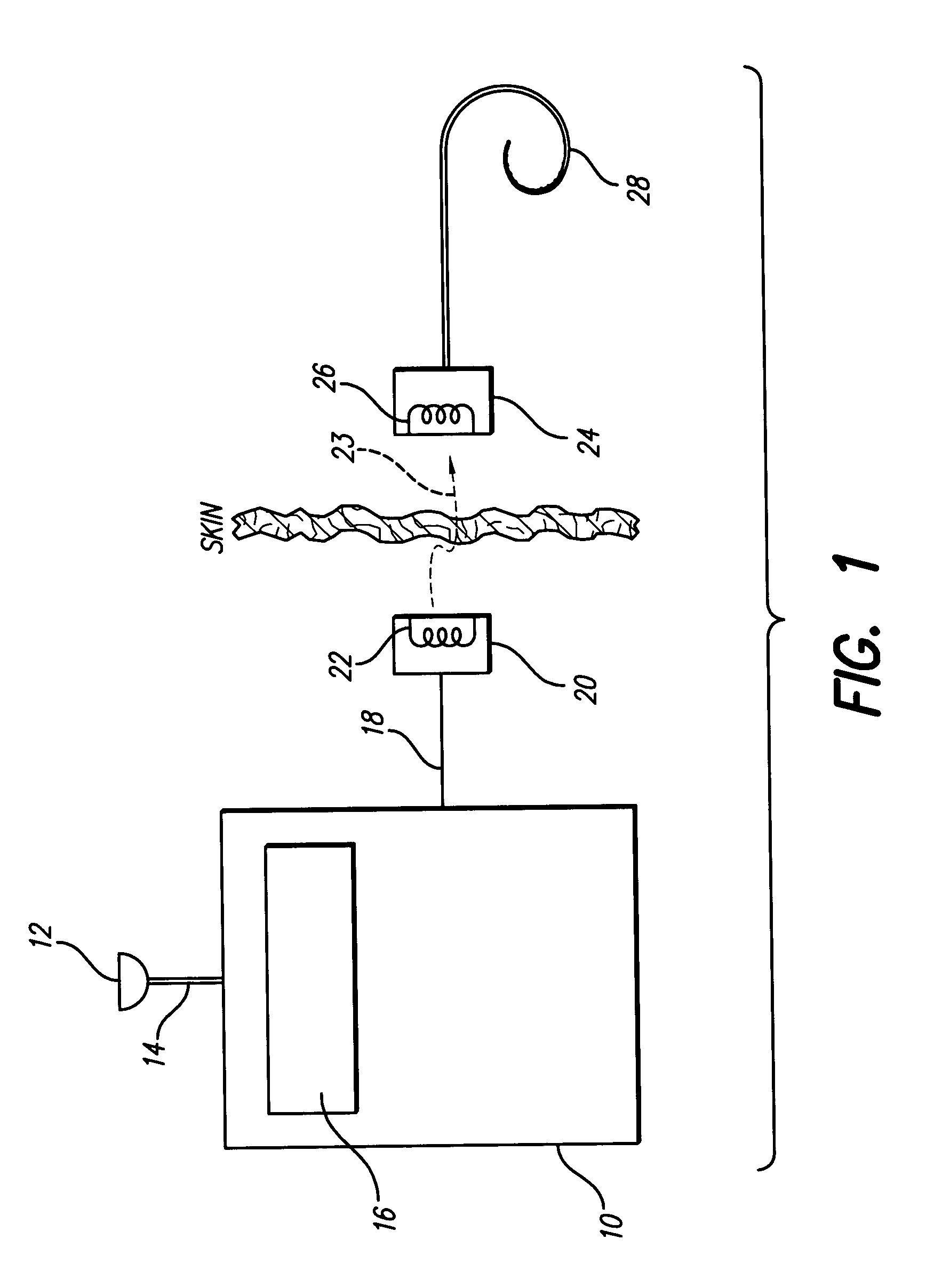 Envelope-based amplitude mapping for cochlear implant stimulus