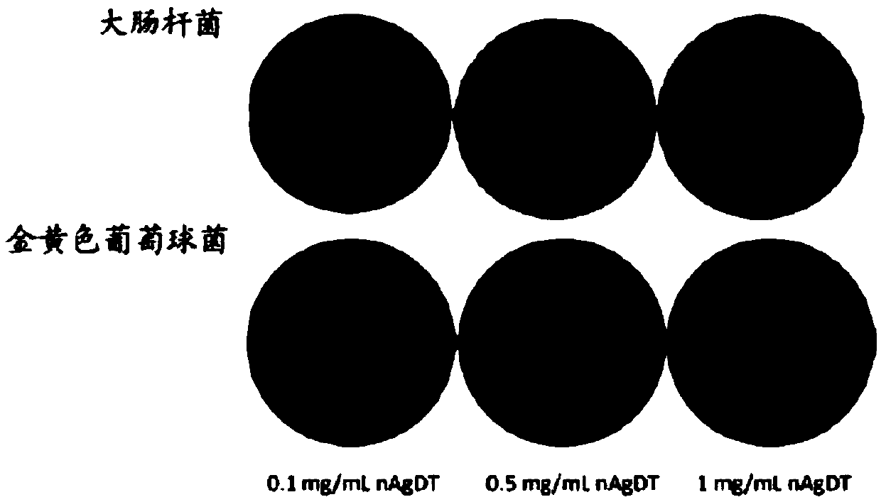 Bone cement as well as preparation method and application thereof