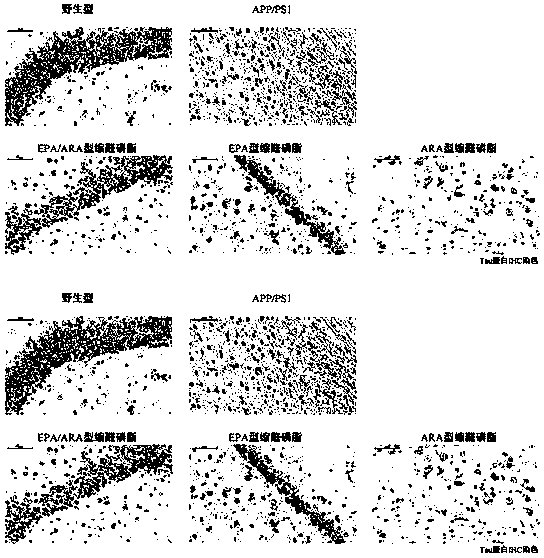 Preparation method and application of EPA/ARA type acetal phospholipid