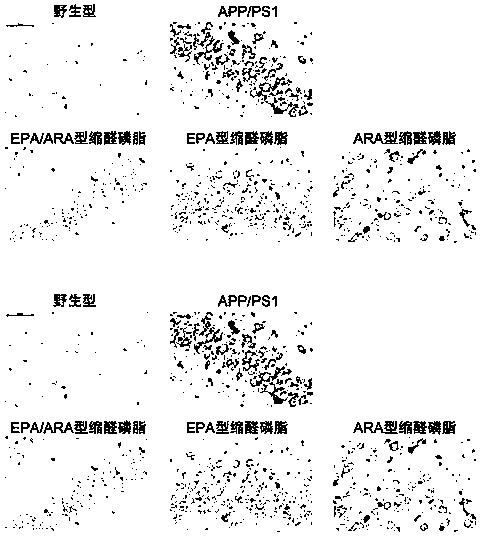 Preparation method and application of EPA/ARA type acetal phospholipid