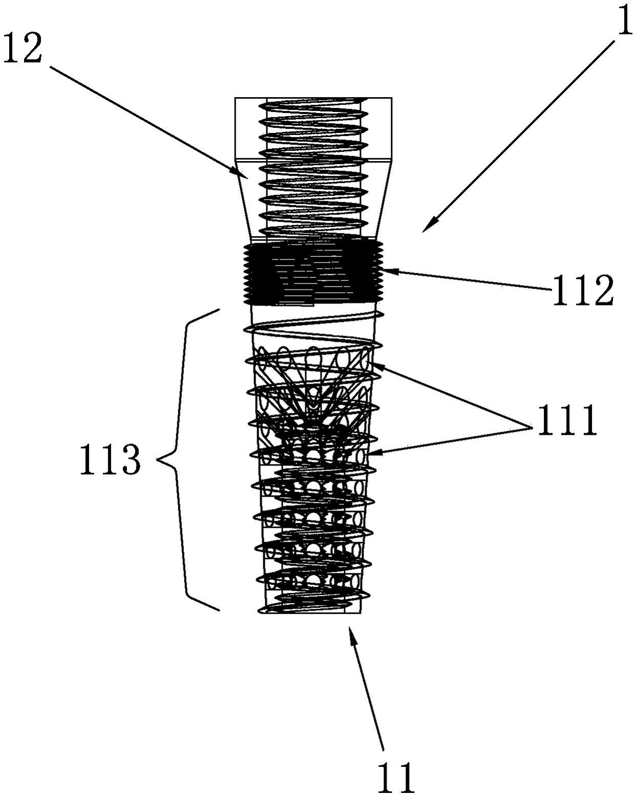 Porous dental implant internally combined with biodegradable magnesium alloy and manufacturing method of porous dental implant