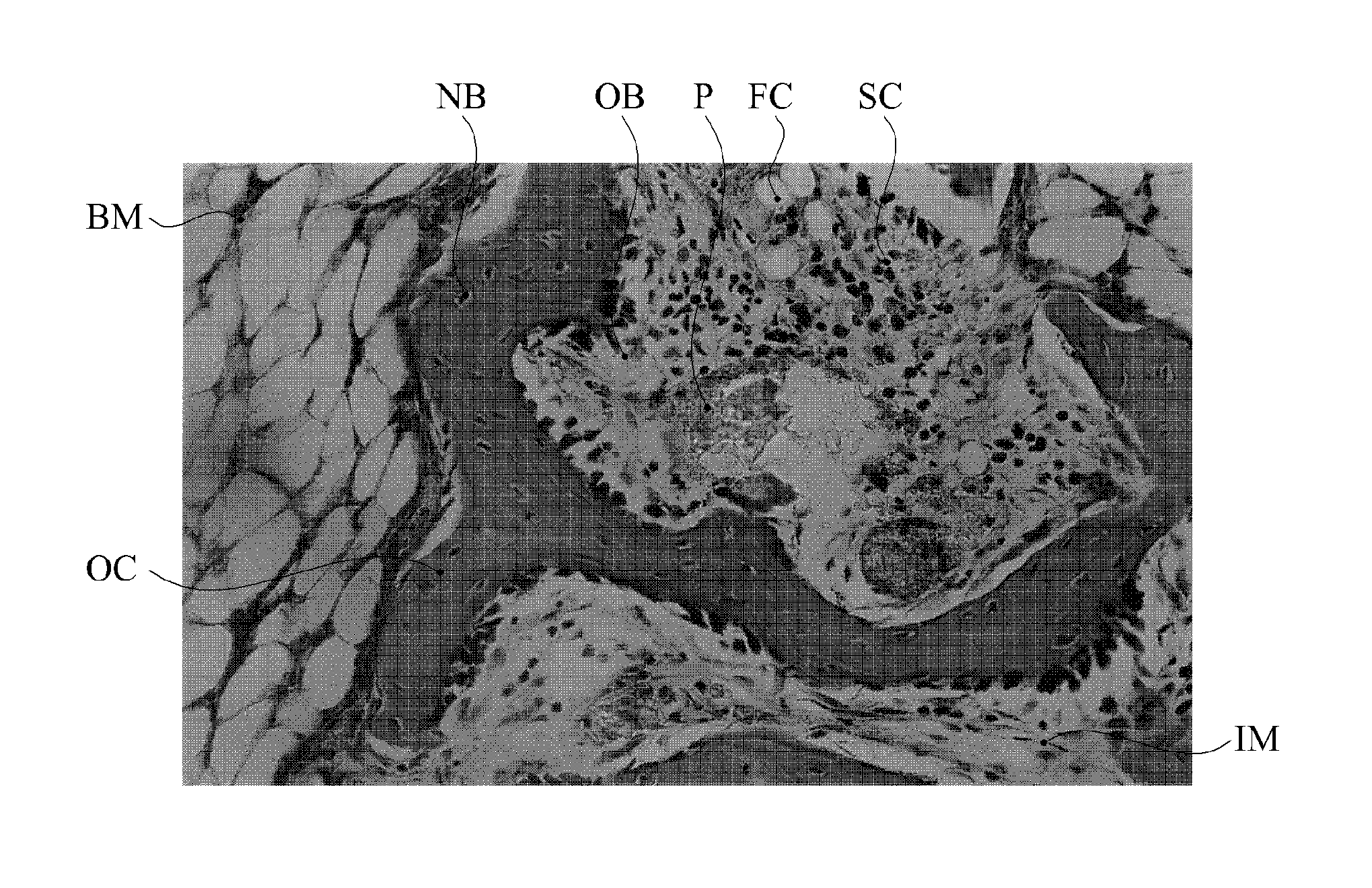 Method for manufacturing a bioactive glass ceramic material