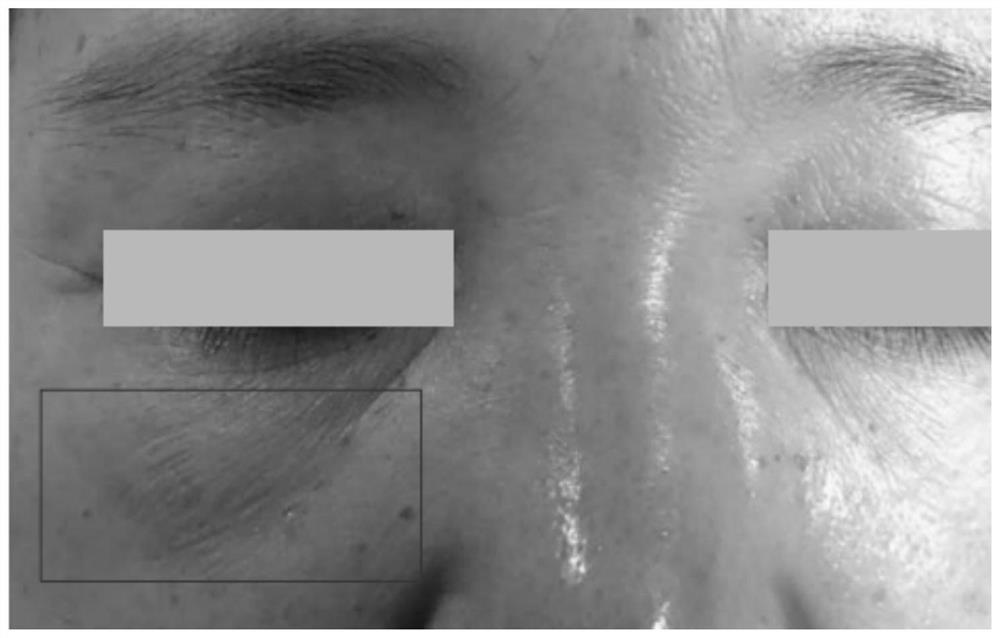 Eye tightening and repairing composition, application, eye cream and preparation method of eye cream