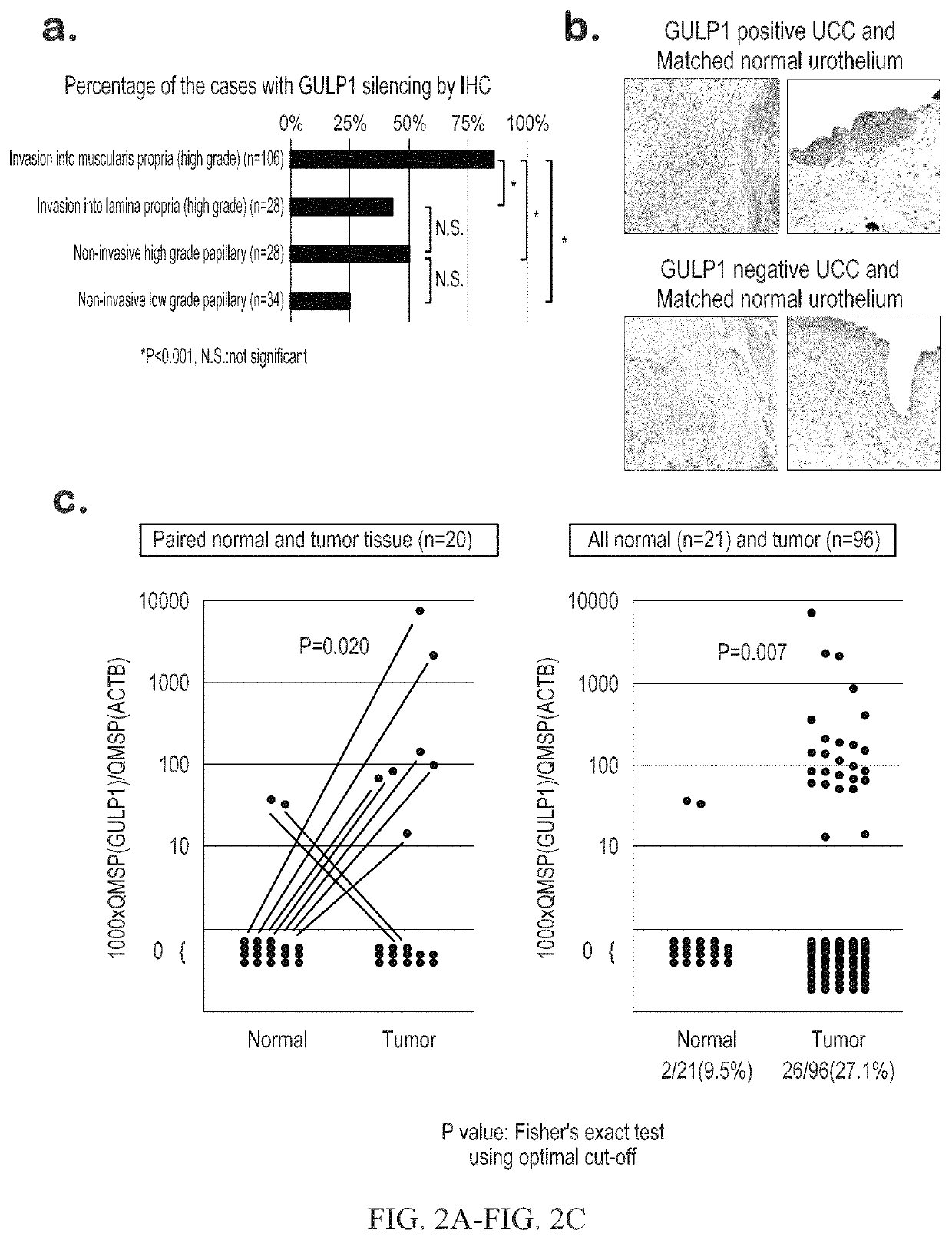 Urothelial cancer and methods of detection and targeted therapy