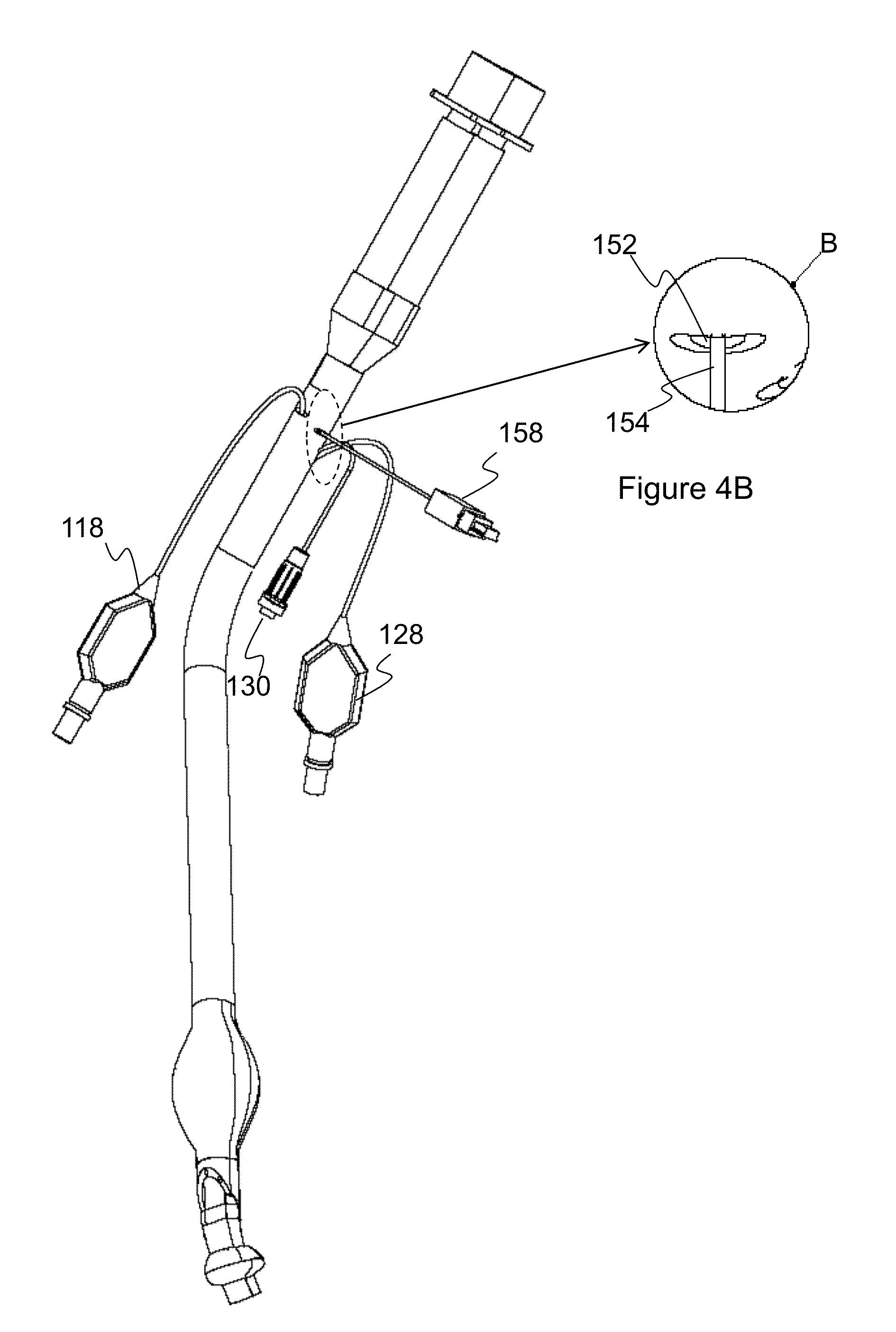 Endobronchial tube with integrated image sensor