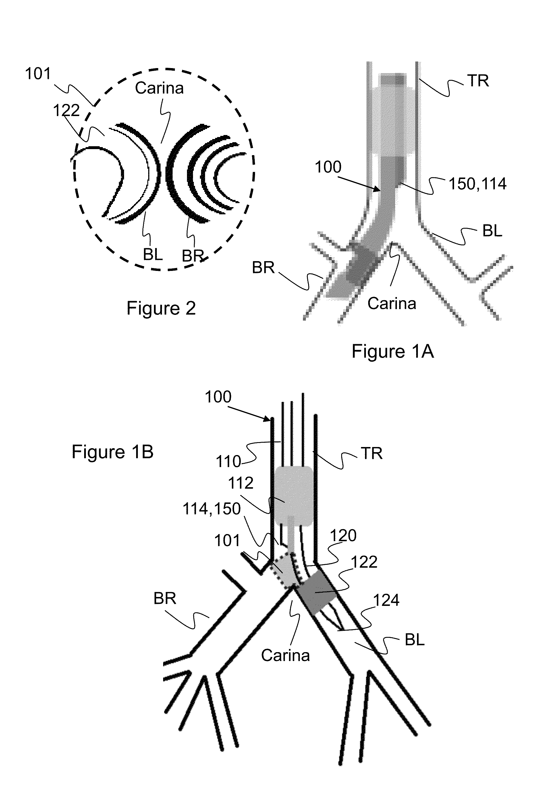 Endobronchial tube with integrated image sensor