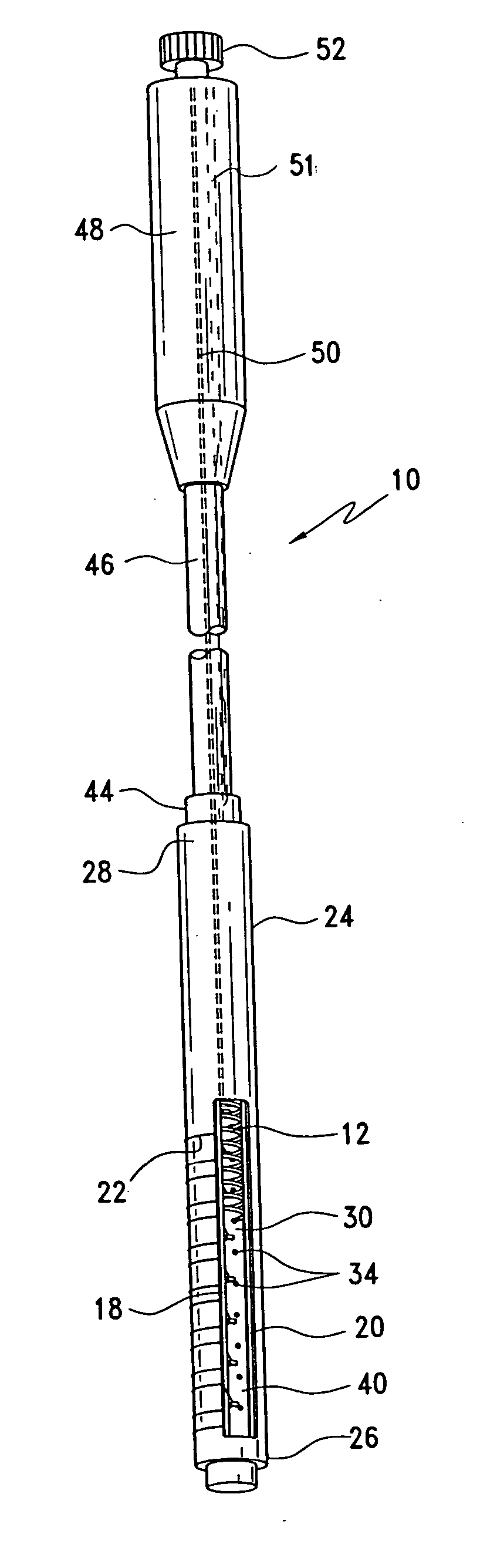 Single pass gastric restriction with a corkscrew style wall anchor