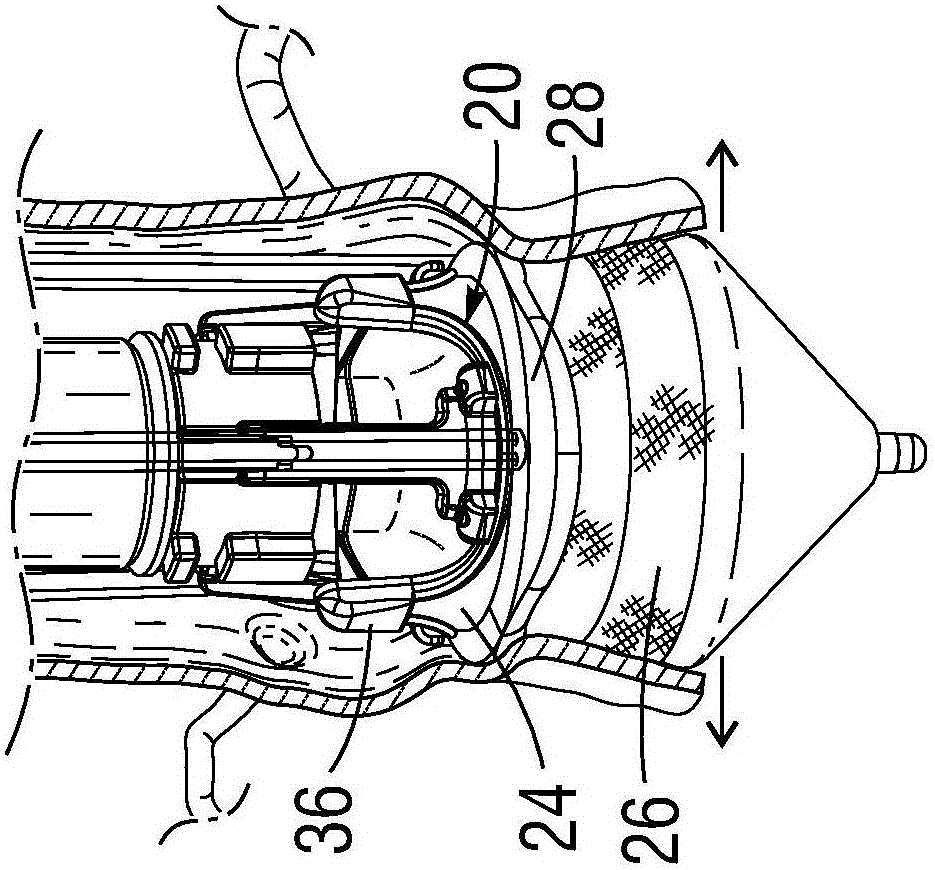 Systems and methods for ensuring safe and rapid deployment of prosthetic heart valves