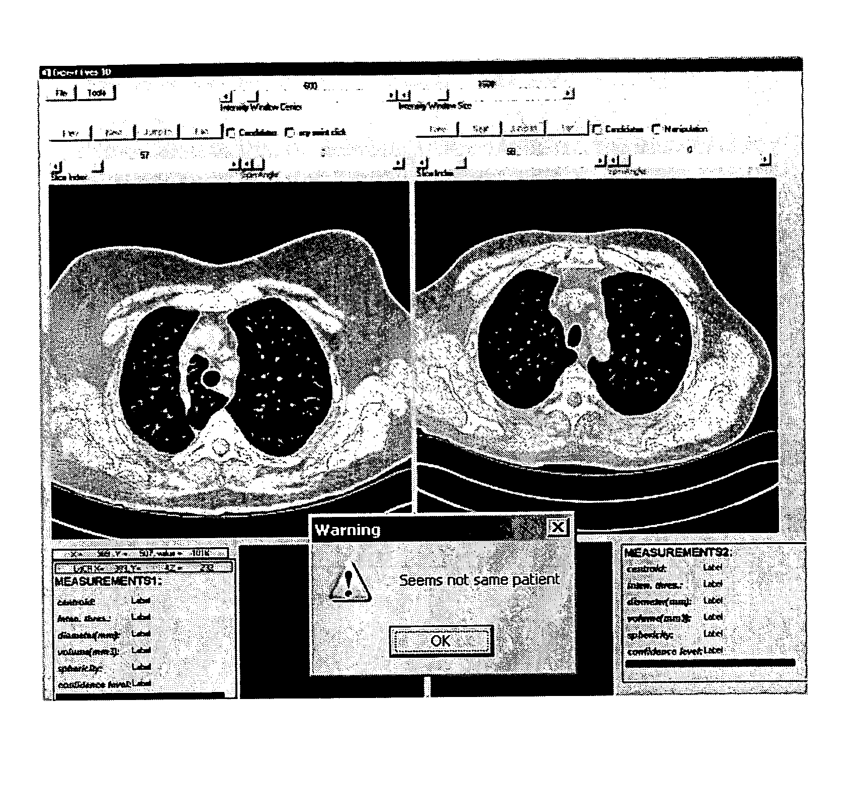 Method and system for patient identification in 3D digital medical images