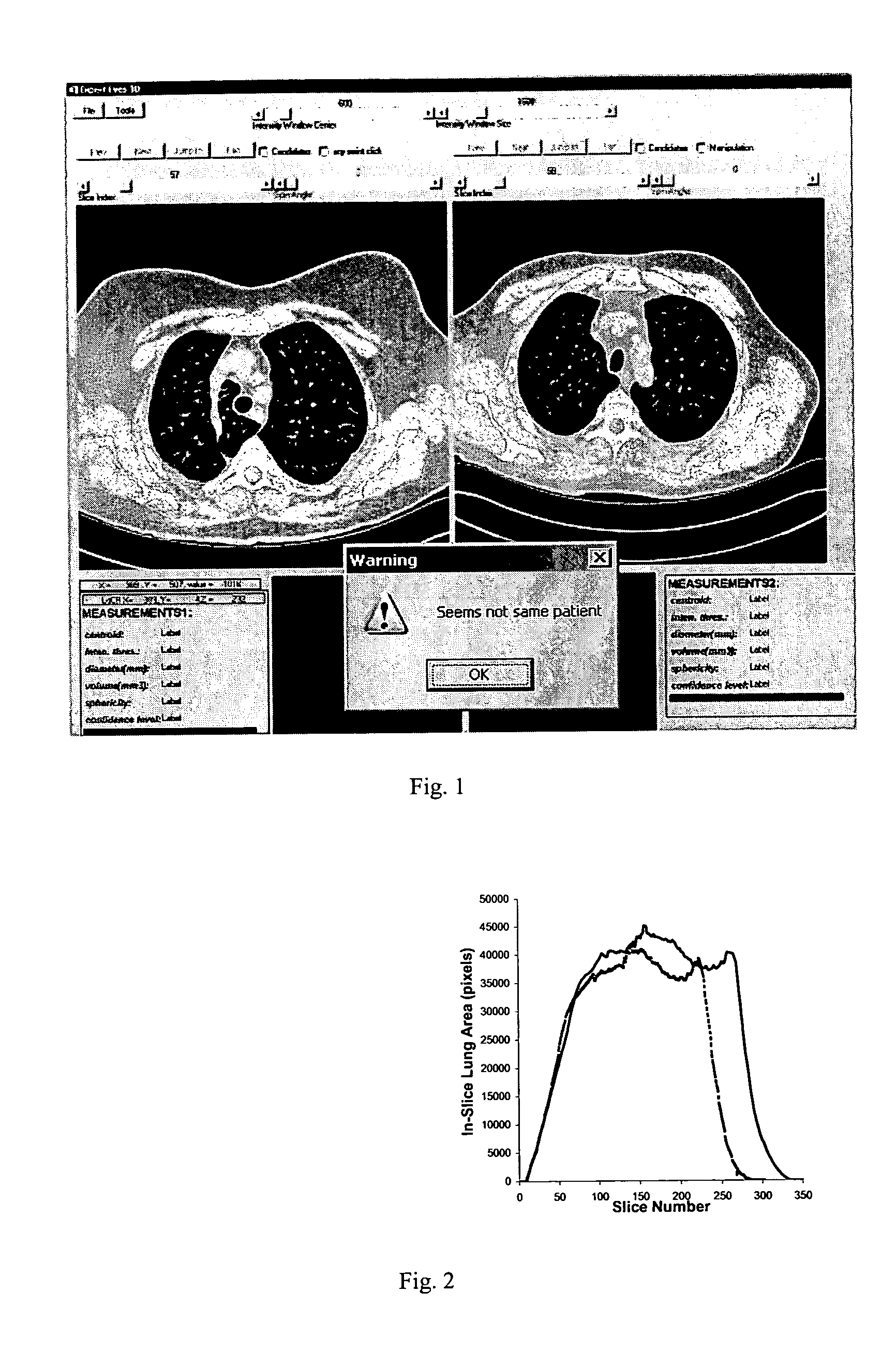 Method and system for patient identification in 3D digital medical images