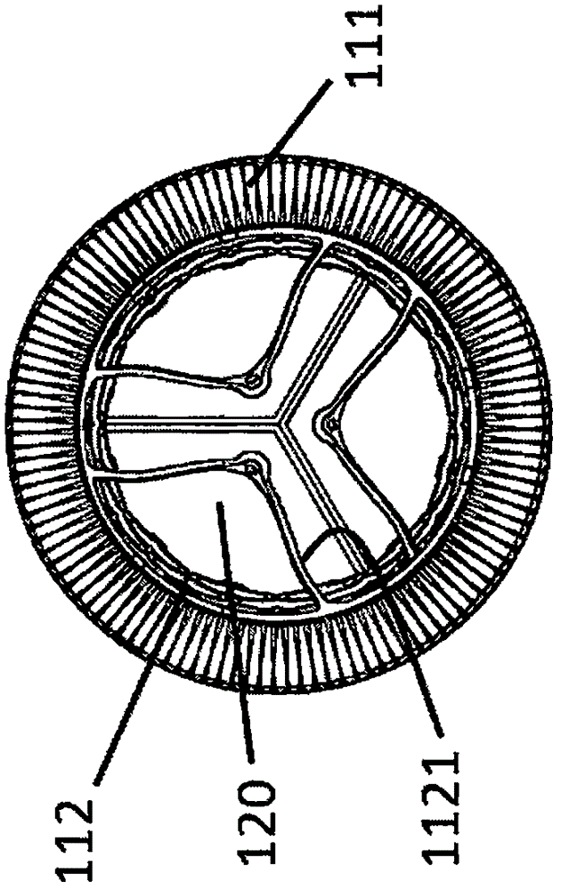 Self-adaptive cardiac valve prosthesis