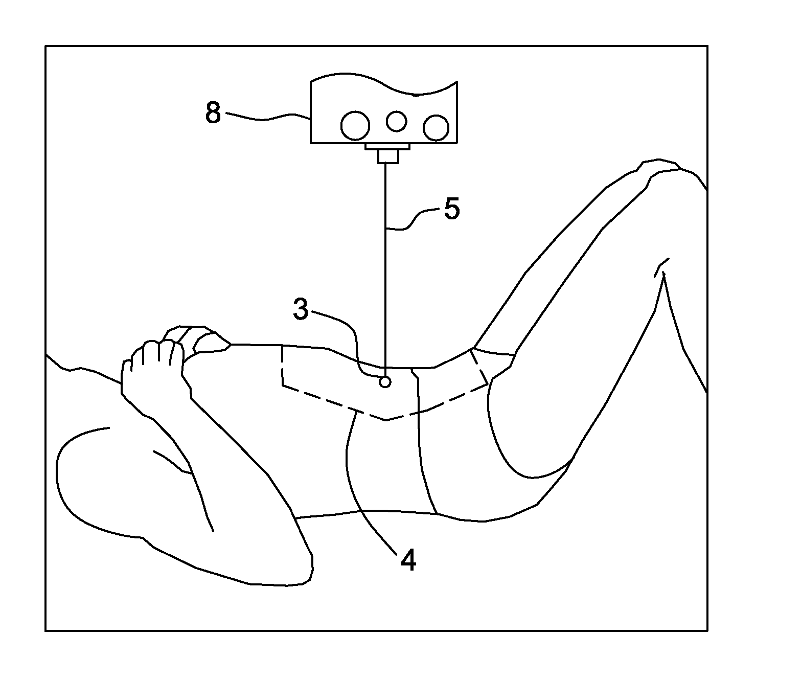 Laser guided auto collimation system and method for medical apparatus