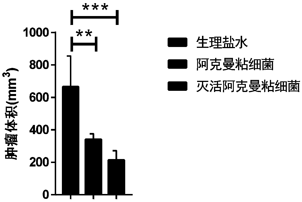 Application of akkermansia muciniphila or prevotella copri to preparation of drugs for enhancing anti-tumor immune function