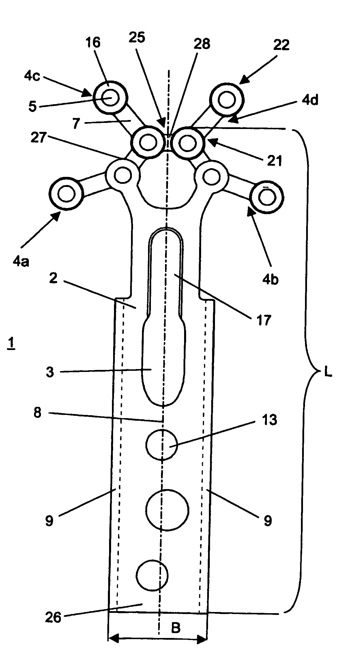 Bone-fixation device