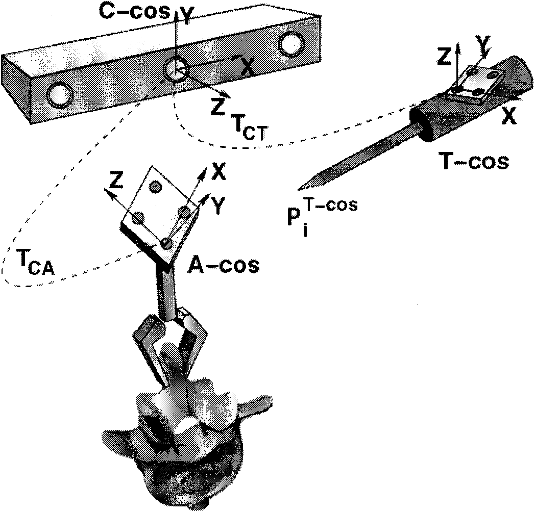 Fixing and navigating surgery system in vertebral pedicle based on structure light image and method thereof