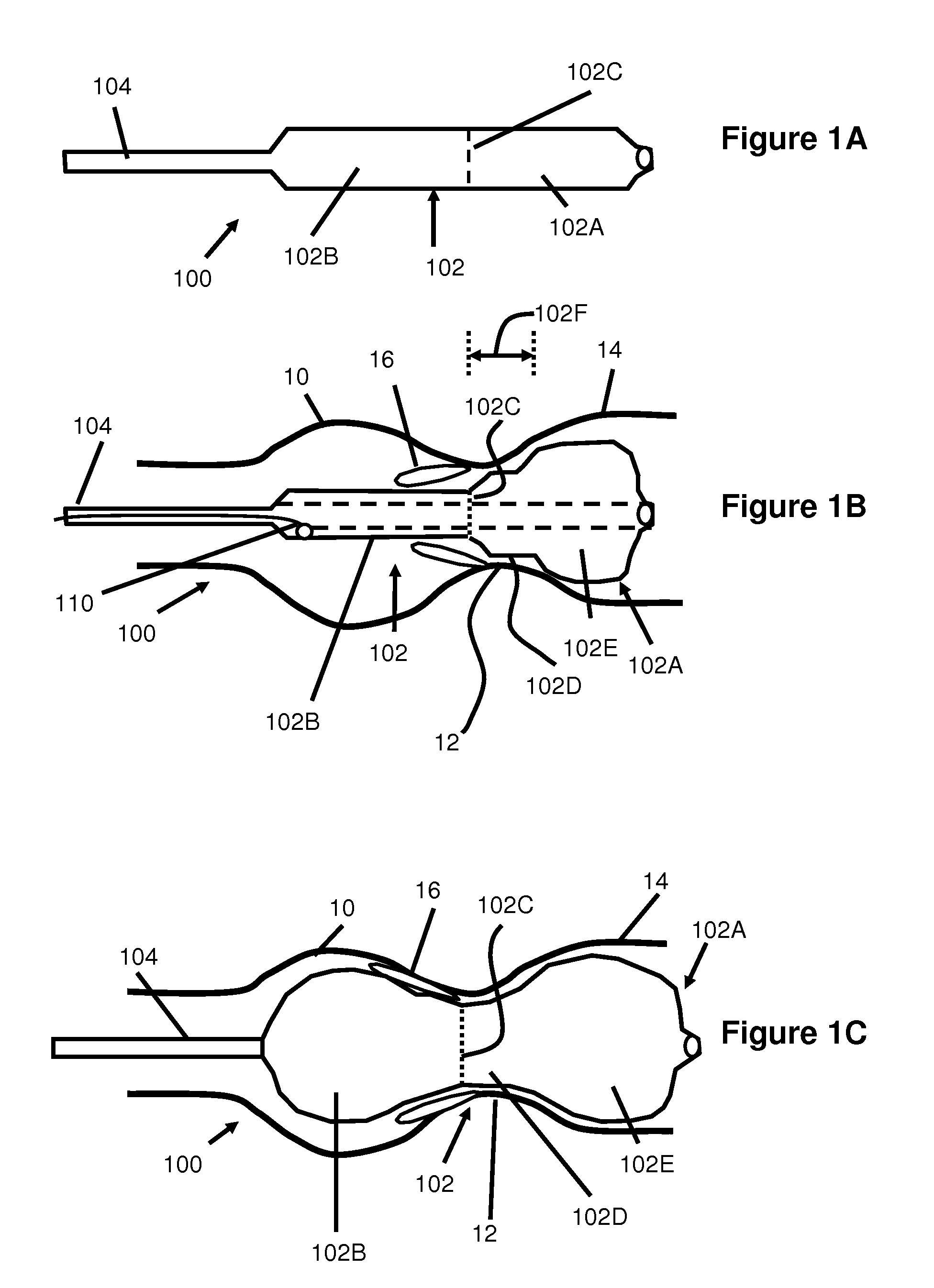 Positionable Valvuloplasty Catheter