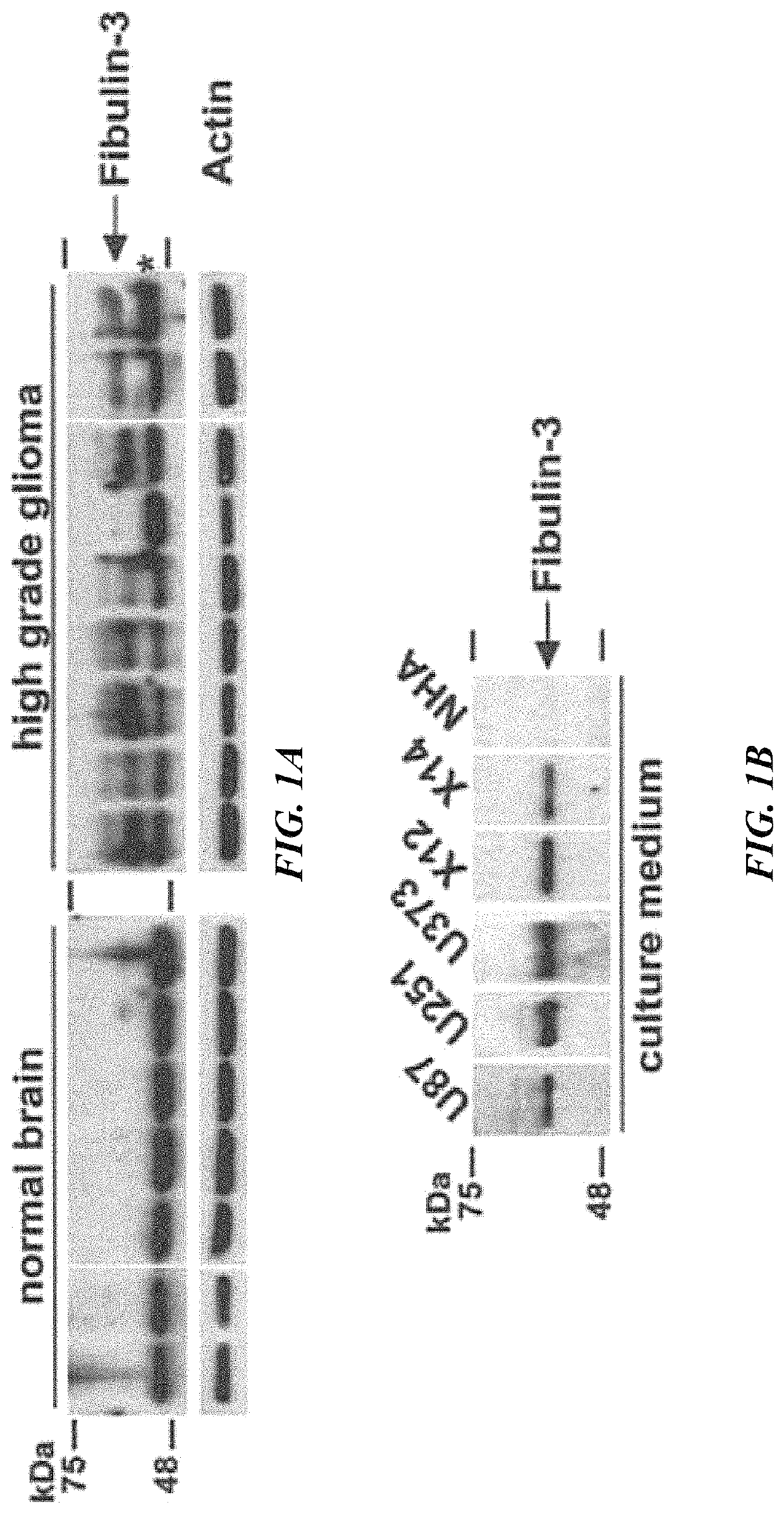 Anti-fibulin-3 antibodies and uses thereof