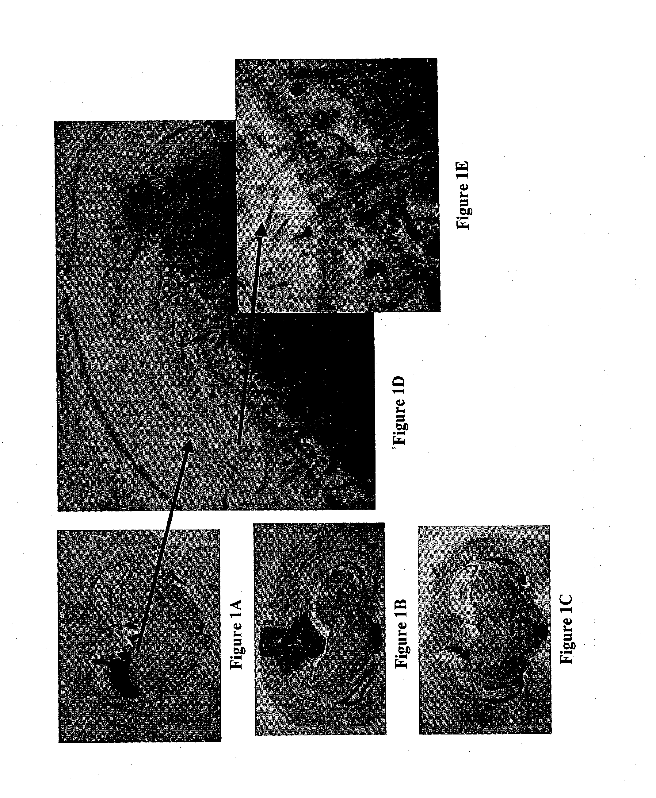 Substituted tetrahydroisoquinoline compounds, methods of making, and their use