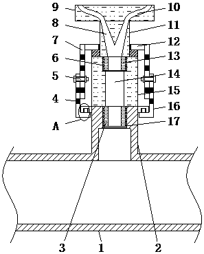 Detachable ring irrigation device