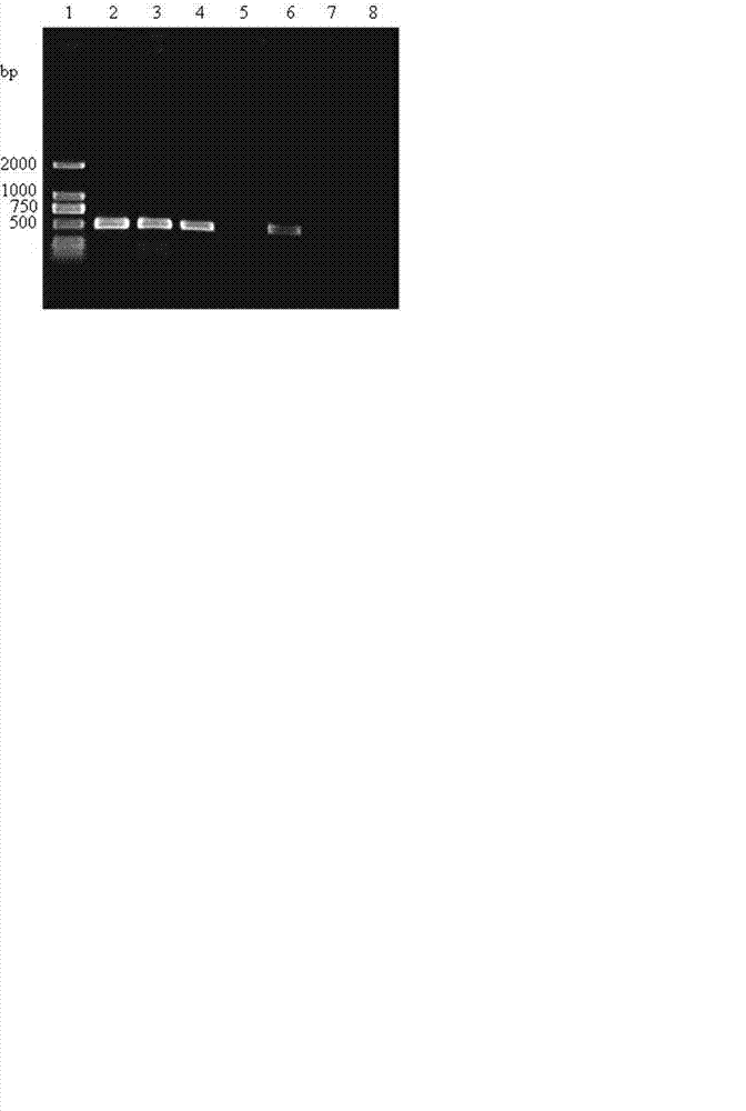 Molecular detection primer for sweet potato black rot germs and application of molecular detection primer