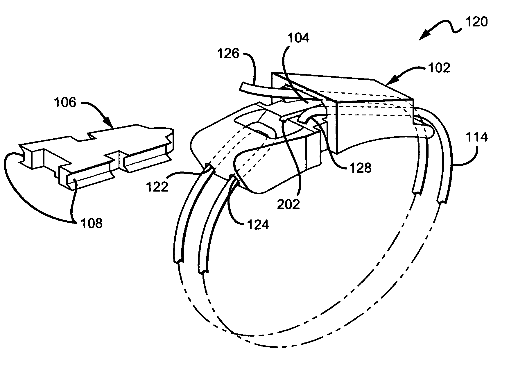 High tension, surgical cable lock