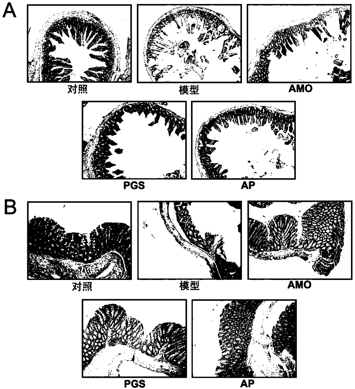 A pharmaceutical composition for treating diarrhea and its preparation method and use