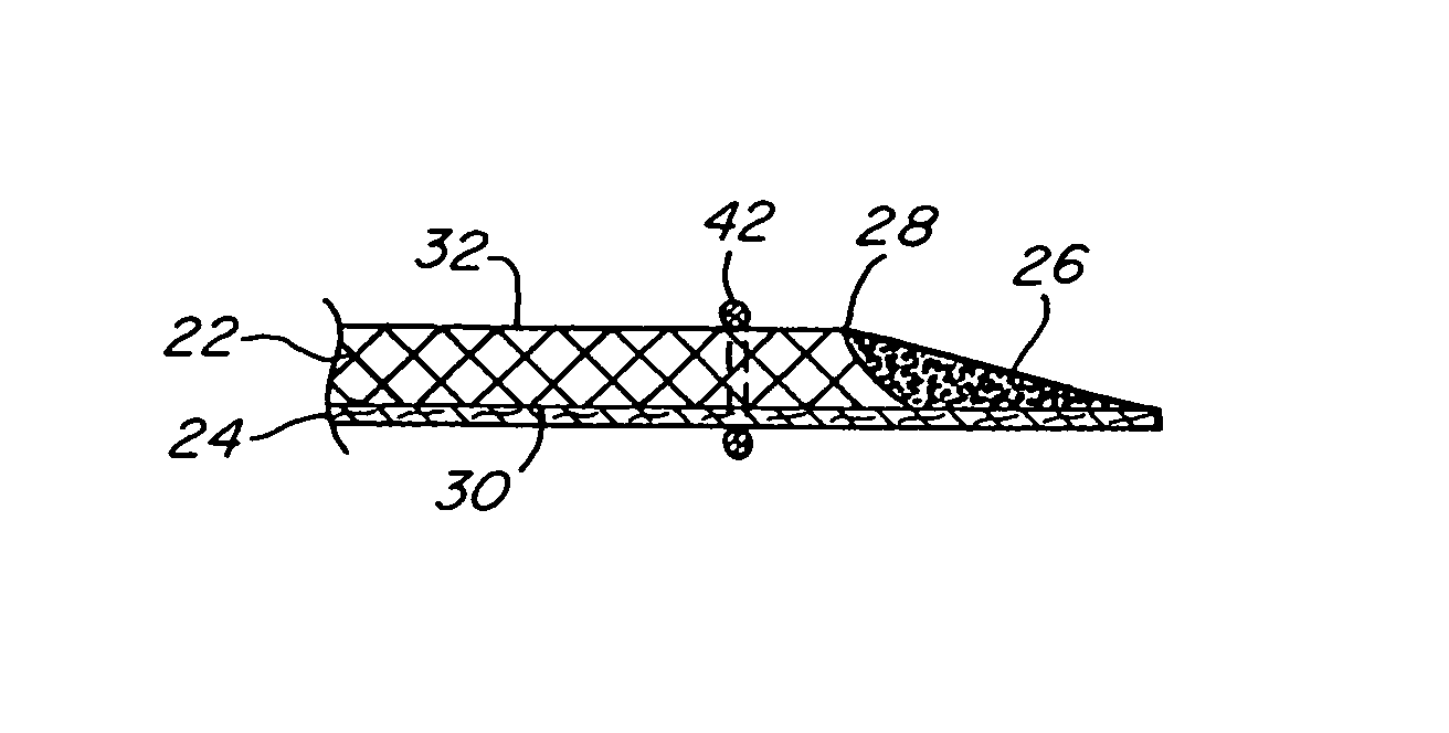 Implantable prosthesis