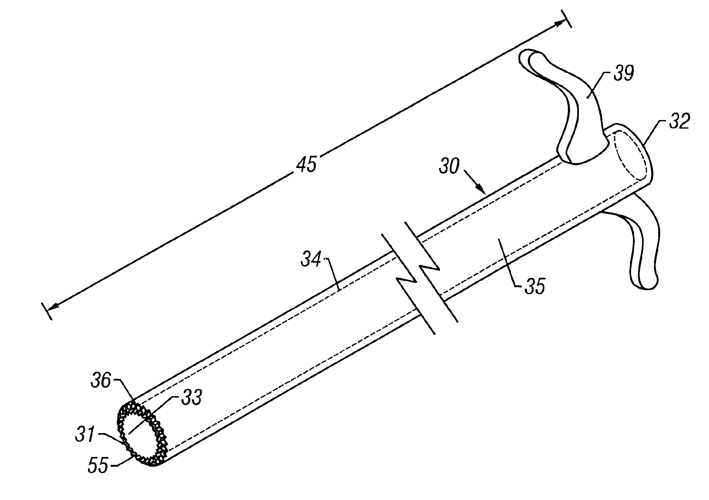 Methods and devices for intraosseous nerve ablation