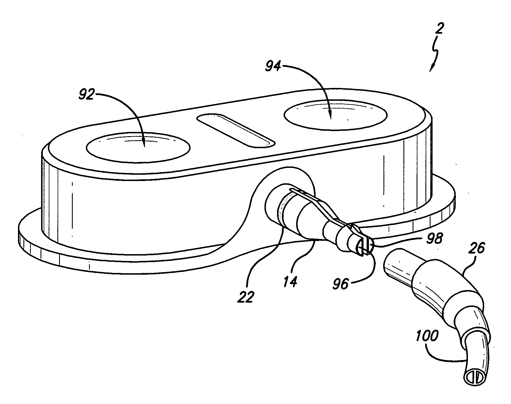 Port stem marking for catheter placement