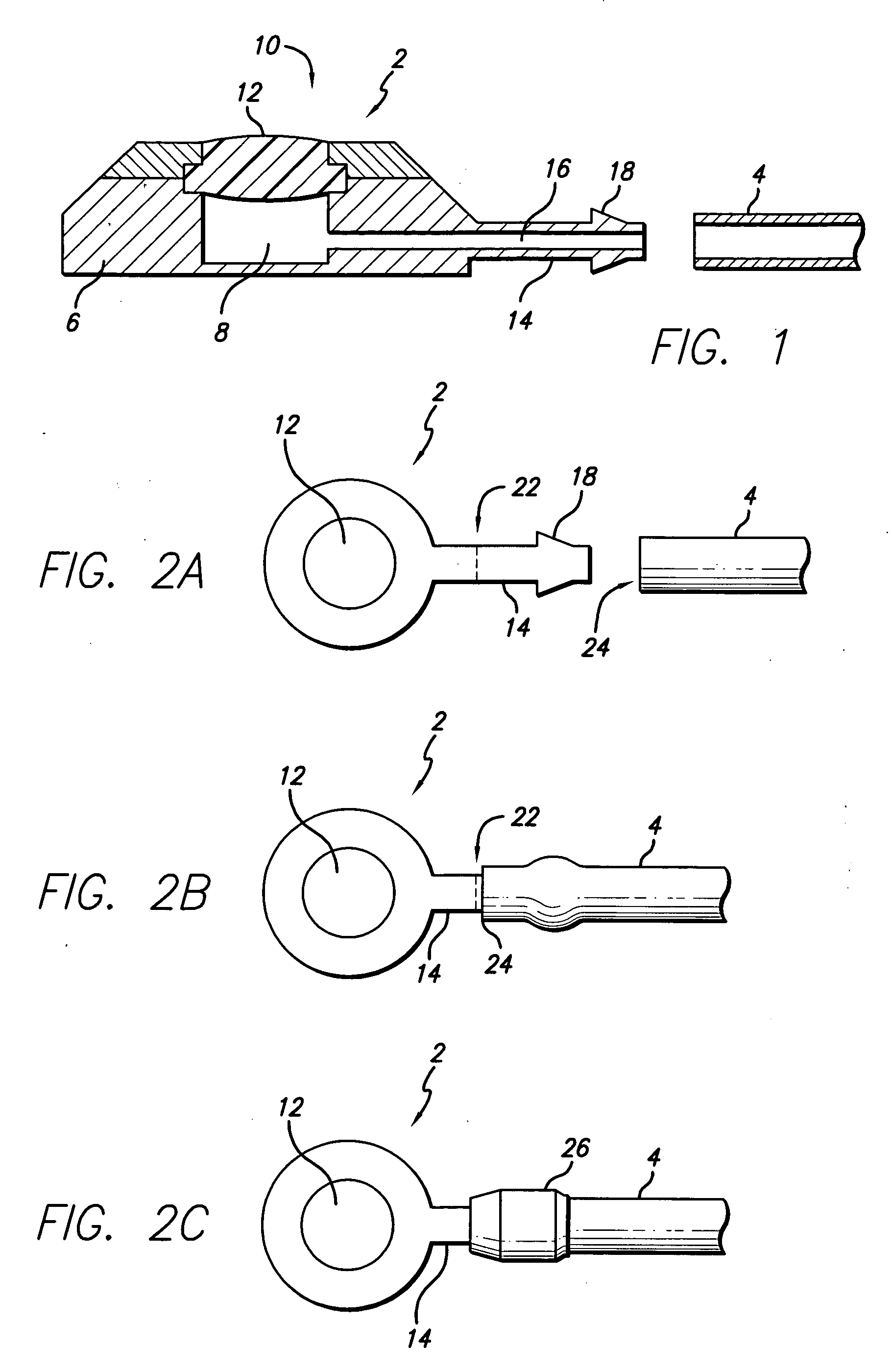 Port stem marking for catheter placement