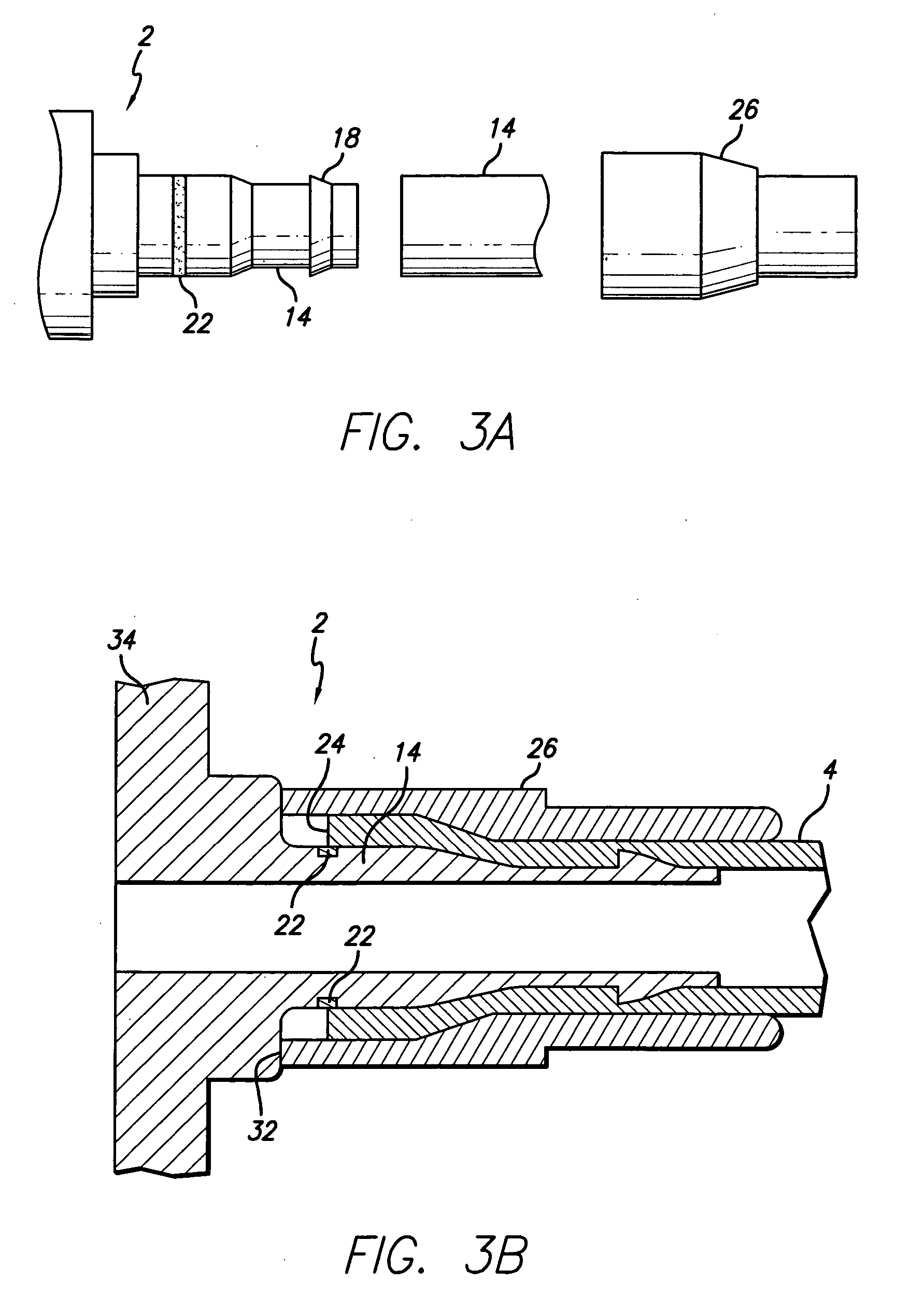 Port stem marking for catheter placement