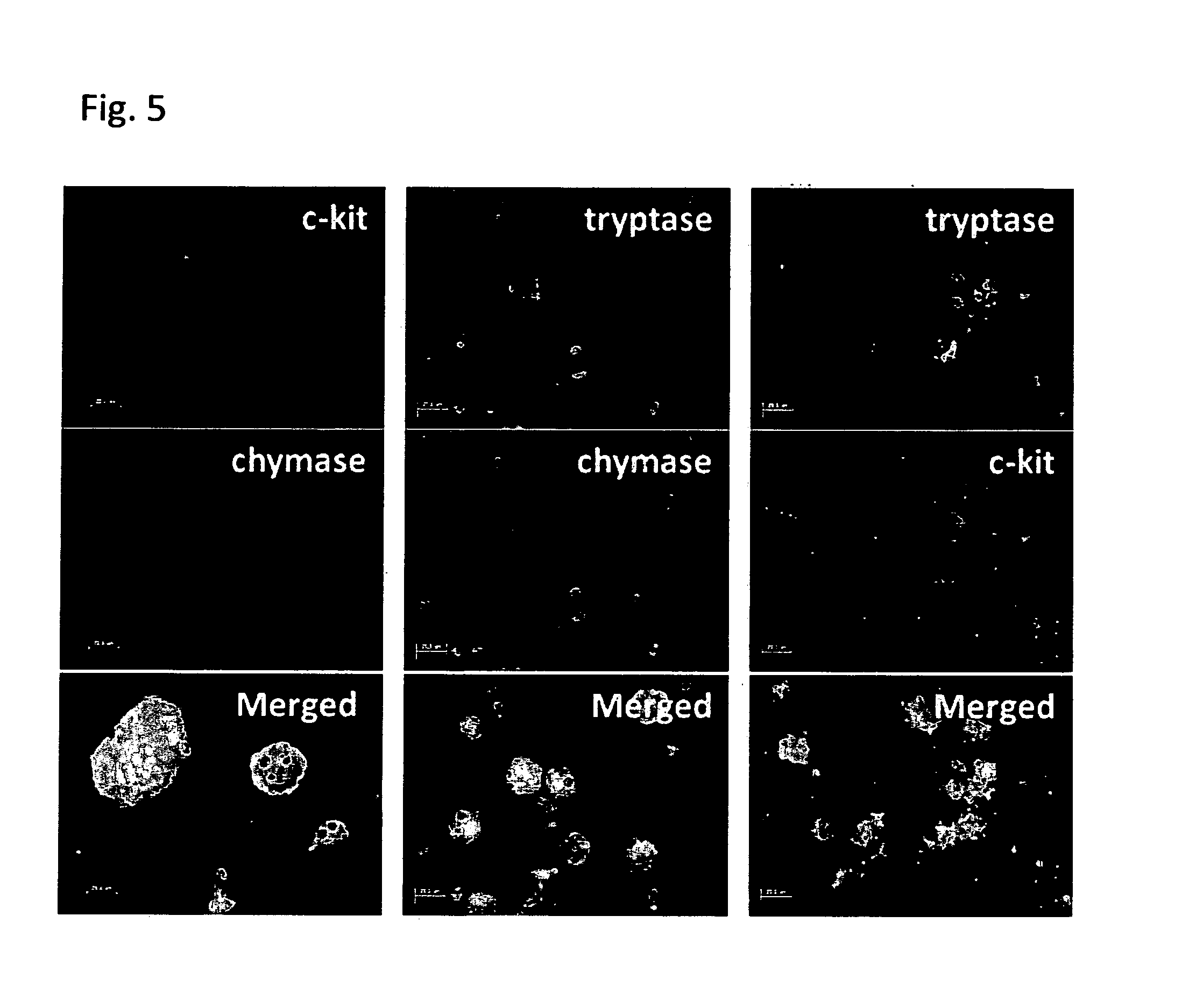 Method for producing mast cells from pluripotent stem cells