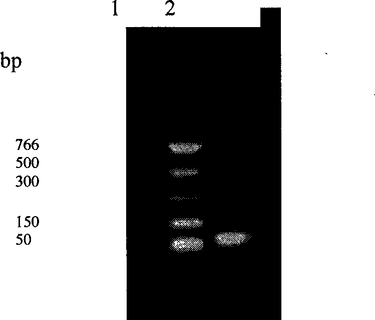 Synthesis of LfcinB15-Mag12 encoding gene and expression method in colon bacillus