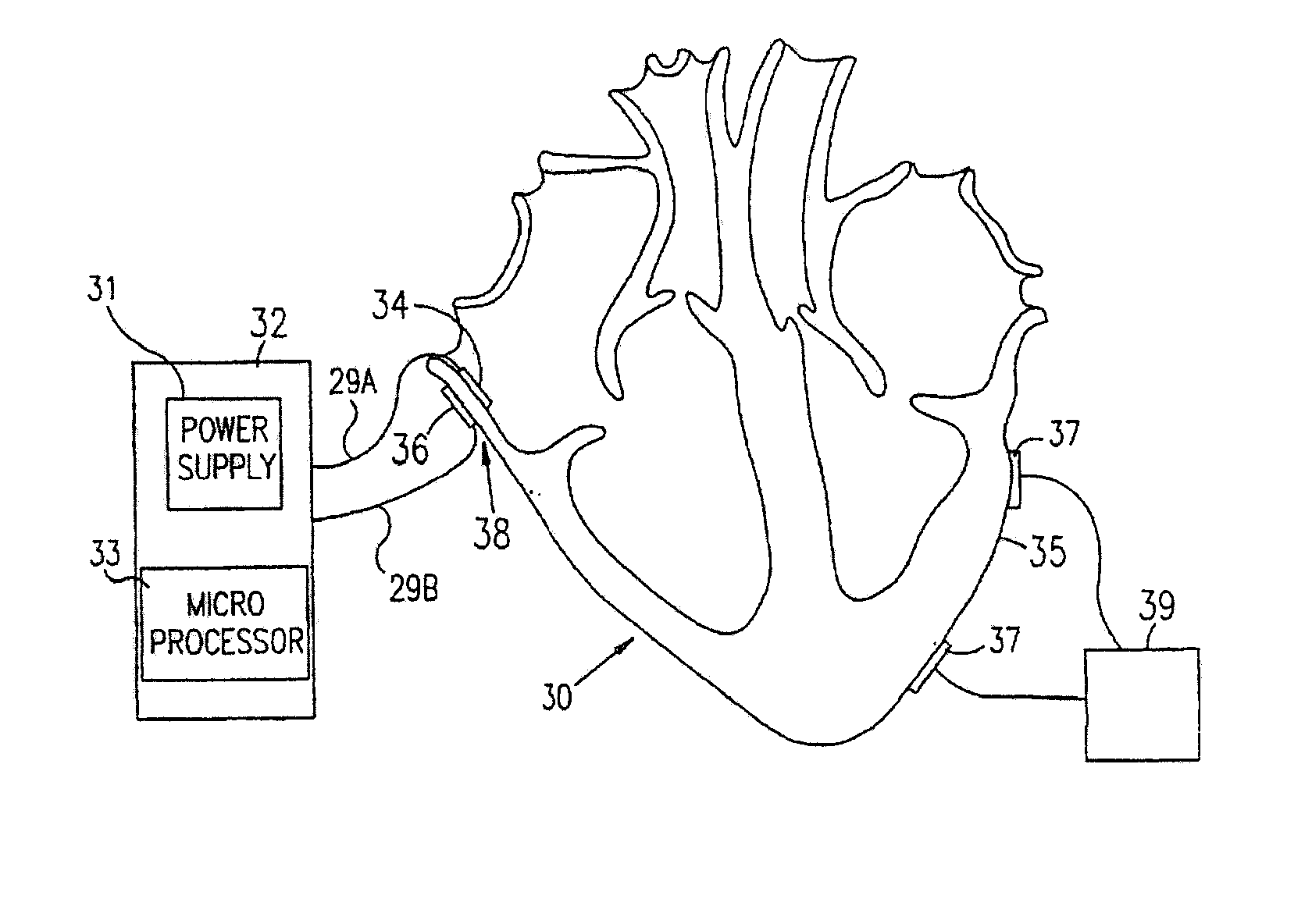 Electrical muscle controller