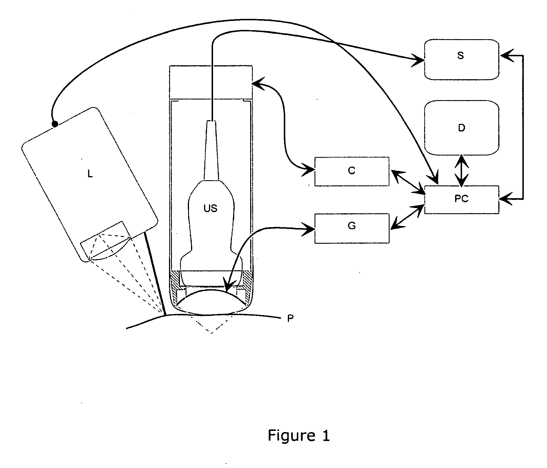 Systems and Methods for Ultrasound Treatment of Thyroid and Parathyroid