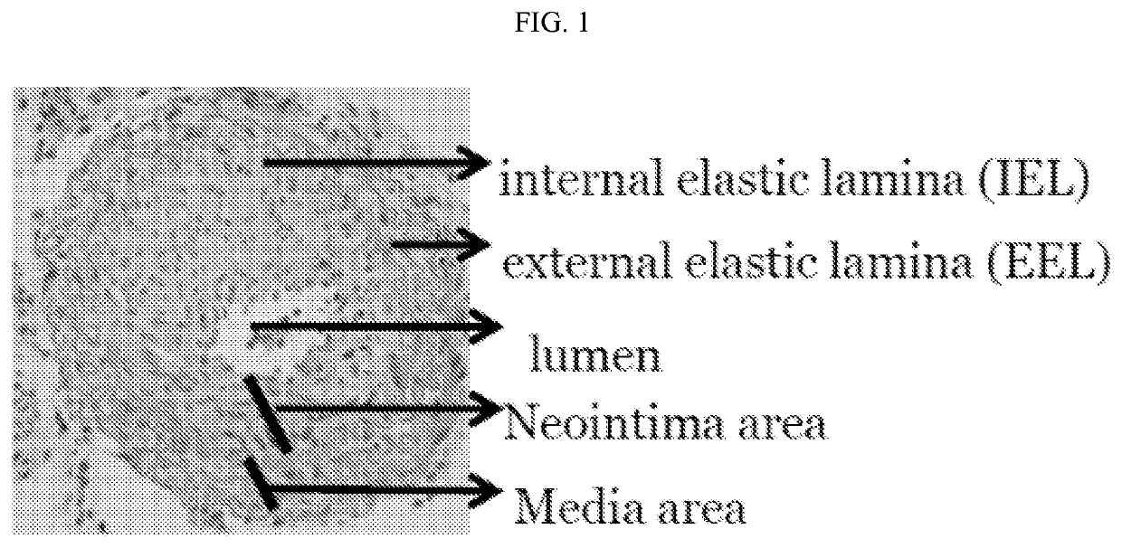 Methods and compositions for treating arteriosclerotic vascular diseases