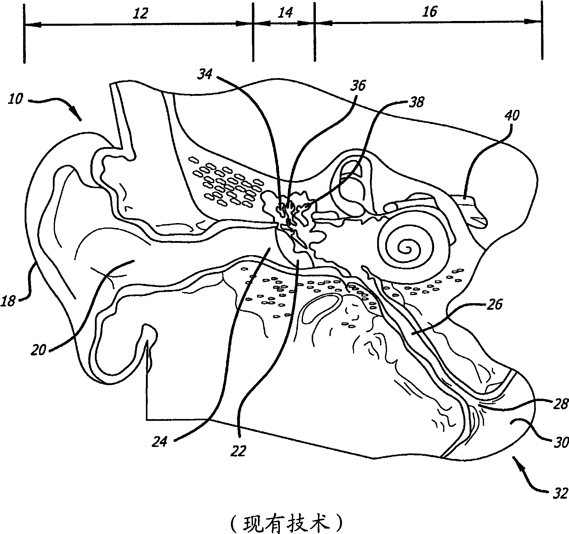 System for treating target tissue within the eustachian tube